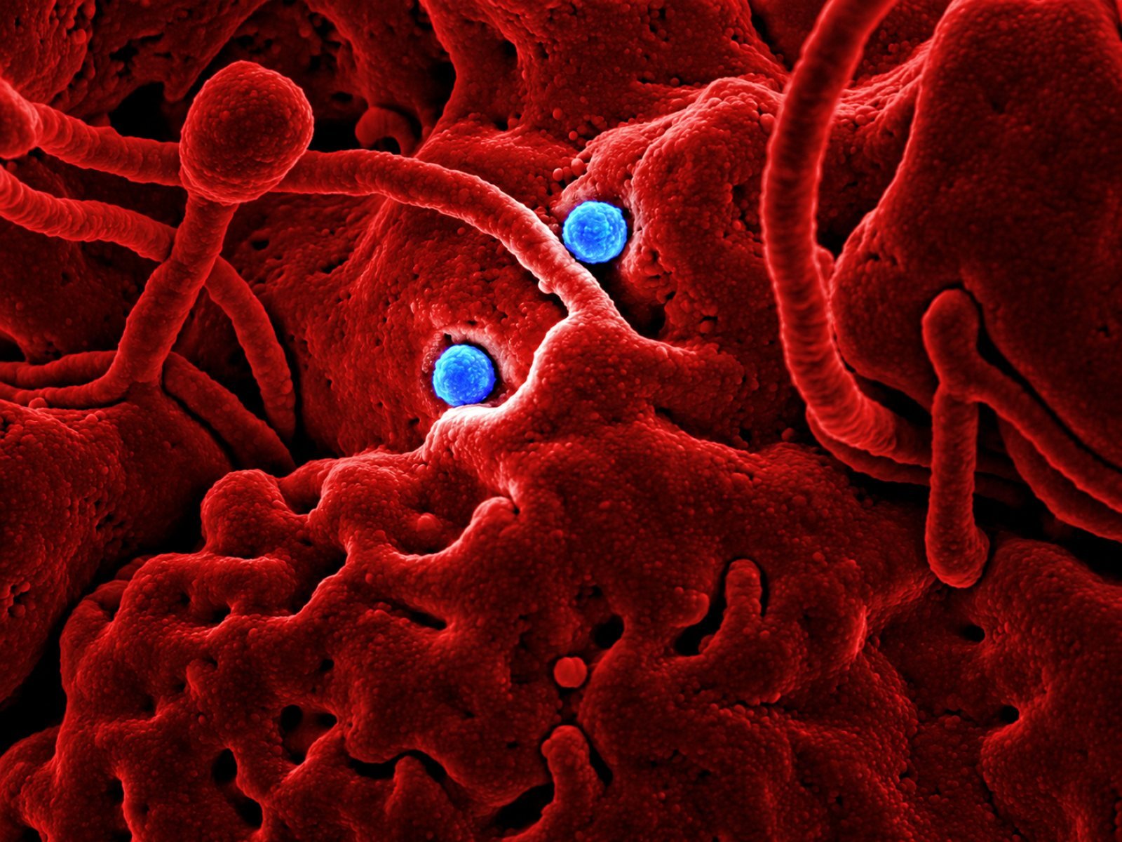 Coloured electron micrograph of small blue particles on the surface of a red cell
